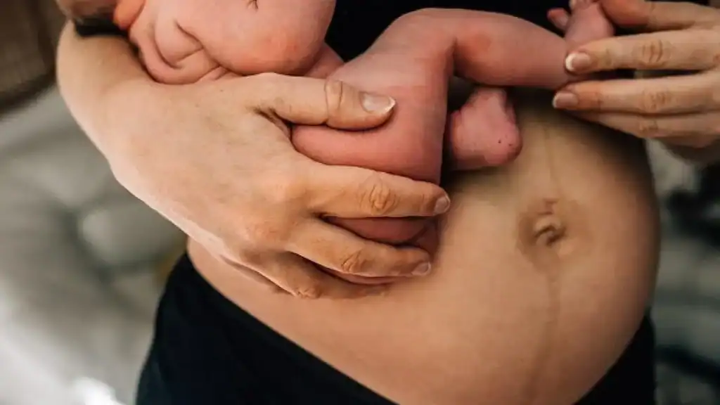 Why Is My Stomach Still Big After Pregnancy Wallingford?