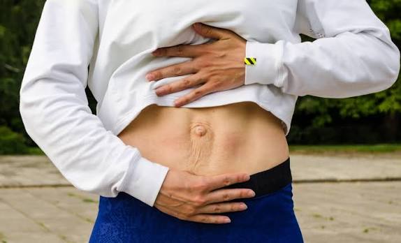 When Could Diastasis Recti Be the Missing Piece of the Puzzle Wallingford?